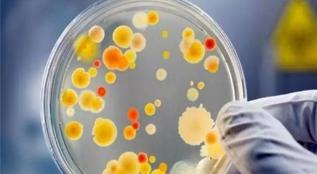 關于微生物檢測常見問題
